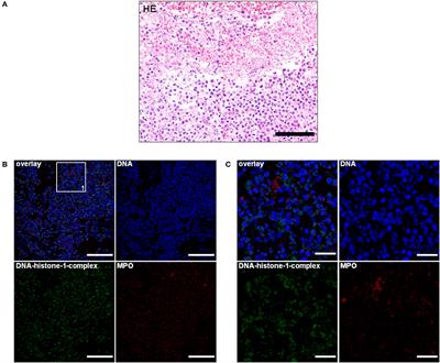 Detection of Extracellular Traps in Canine Steroid-Responsive Meningitis-Arteritis